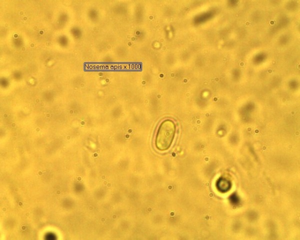 Nosema apis under microscope X1000