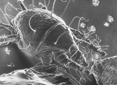 Electron micrograph of an Acarapis woodi mite in black and white. The mite has eight short legs and hairs on its body.